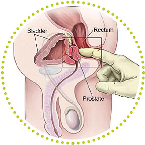 prostate_massage Learn it, love it!