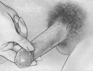 Lingam14A Squeeze 101